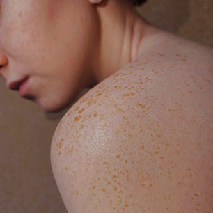 The "Brass" Effect: Why Your Blonde Turns Orange (And How to Stop It)