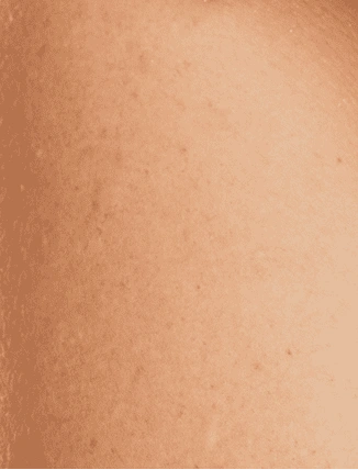 Hydrated Skin